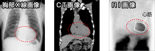 各検査での心臓の写り方