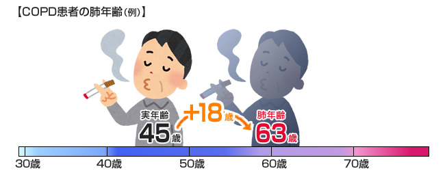 COPD患者の肺年齢